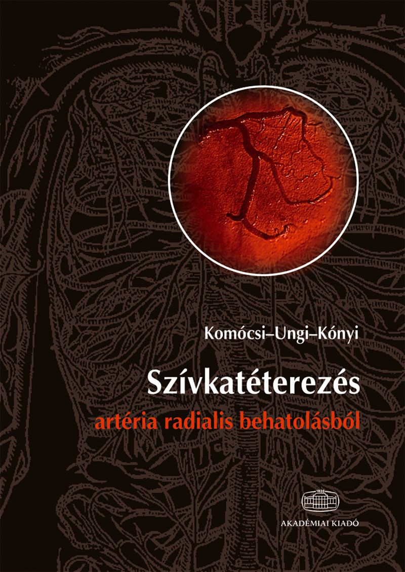 Szívkatéterezés artéria radialis behatolásból
