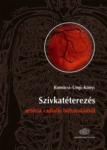 Szívkatéterezés artéria radialis behatolásból